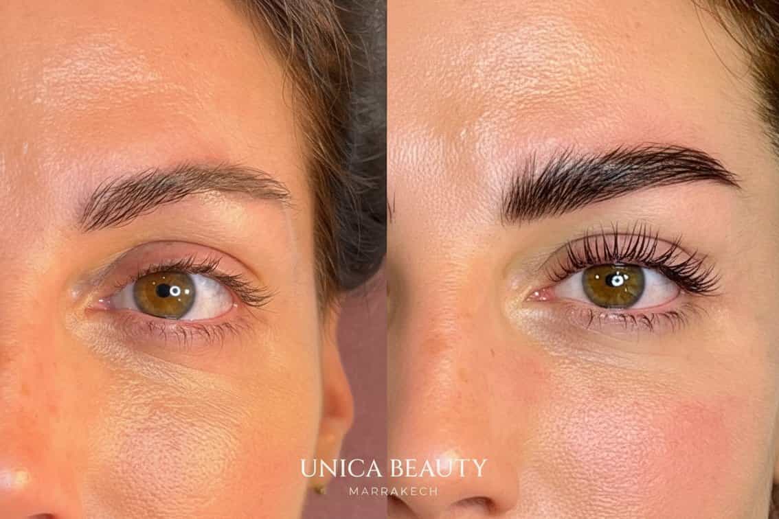 Unica Beauty 6