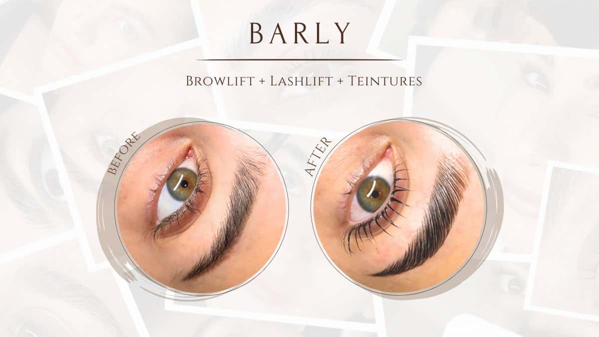 Barly Beauty Bar 5