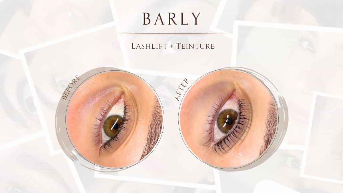 Barly Beauty Bar 6